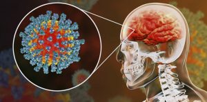 কোভিডের সাথে সম্পর্ক স্নায়ুরোগের : গবেষণা